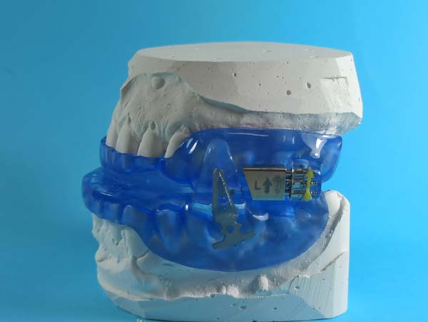 Ortodoncia, aparatos apnea